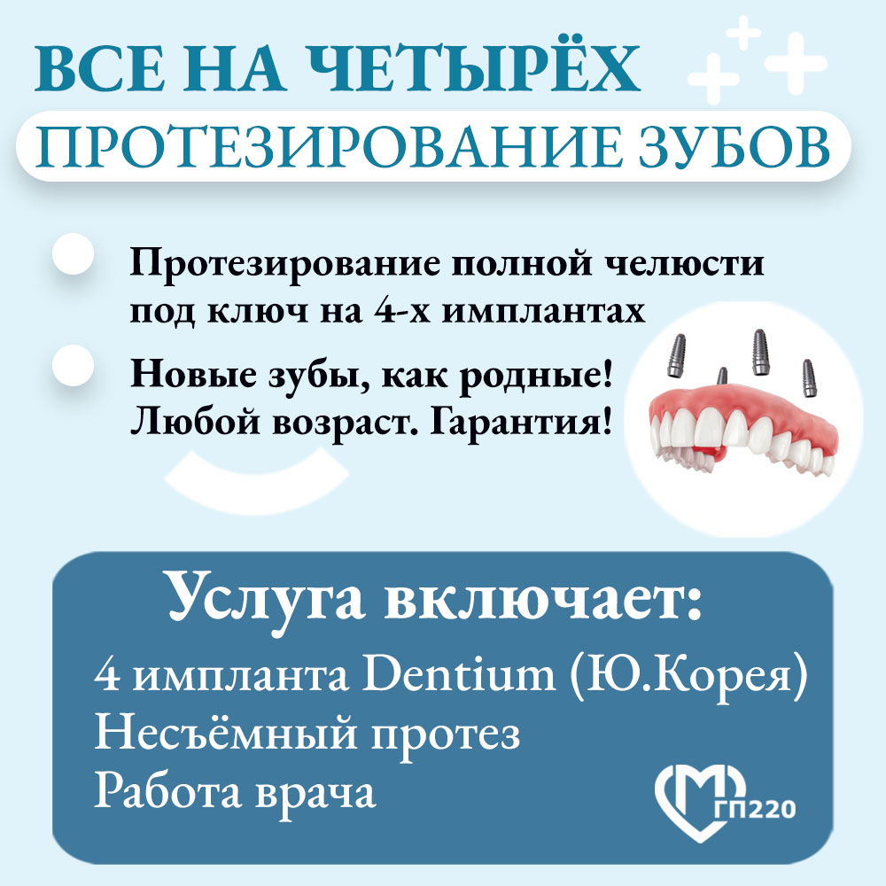 Имплантация Все на четырёх имплантах