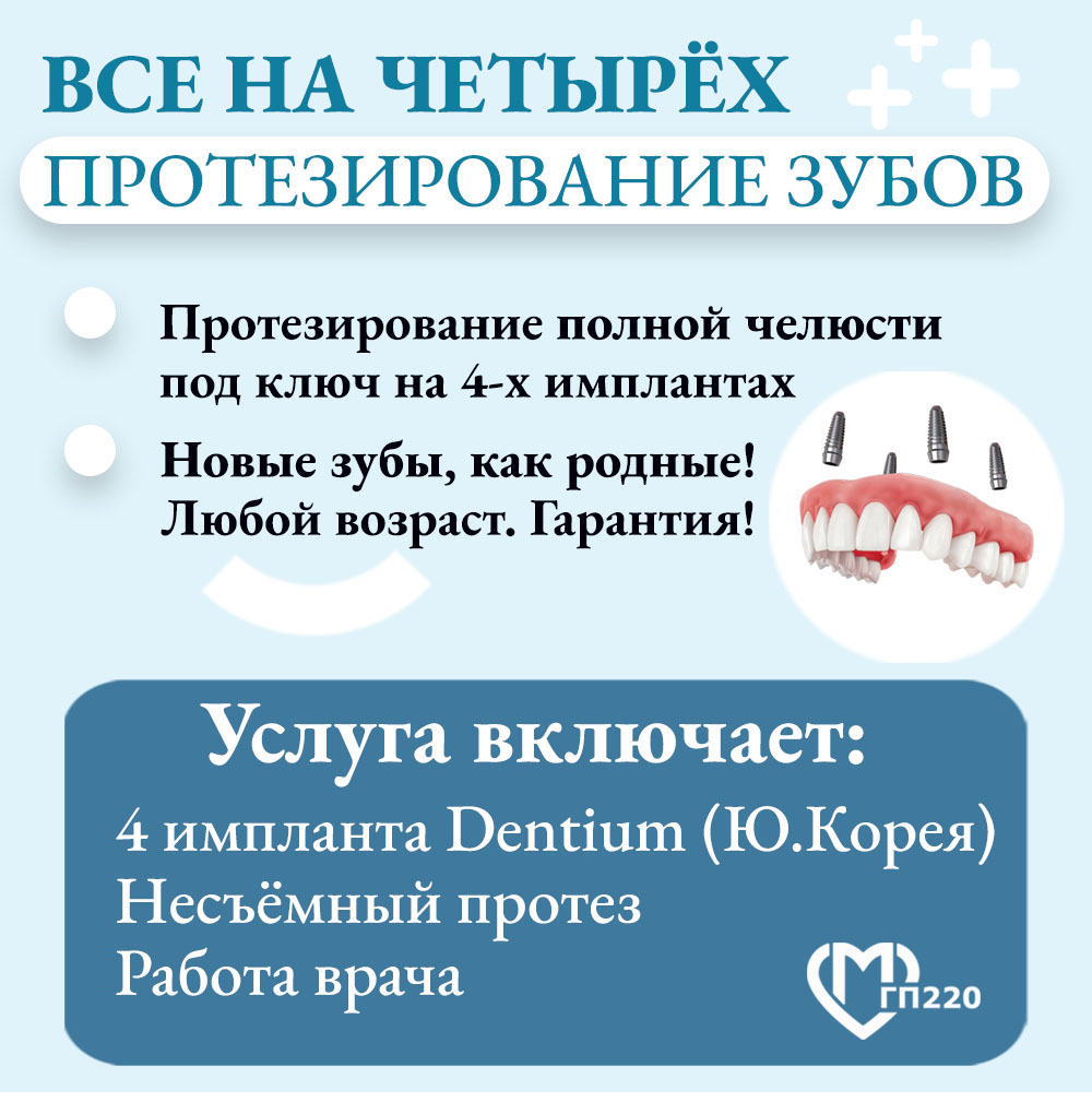Имплантация Все на четырёх имплантах