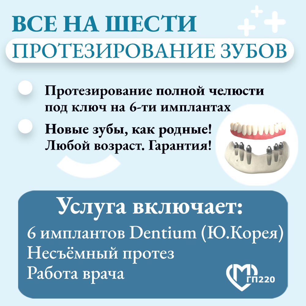 Имплантация Все на шести имплантах при отсутствии зубов