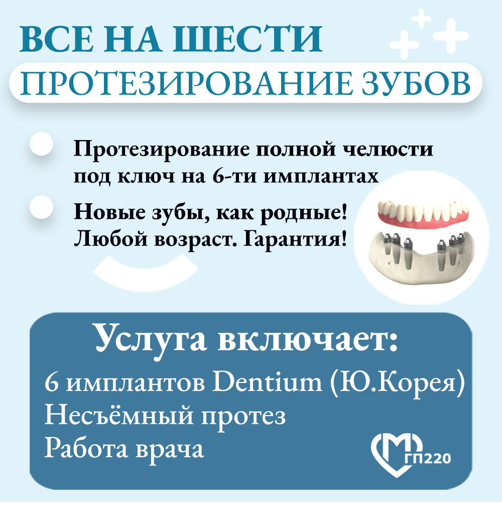 Имплантация Все на шести имплантах при отсутствии зубов