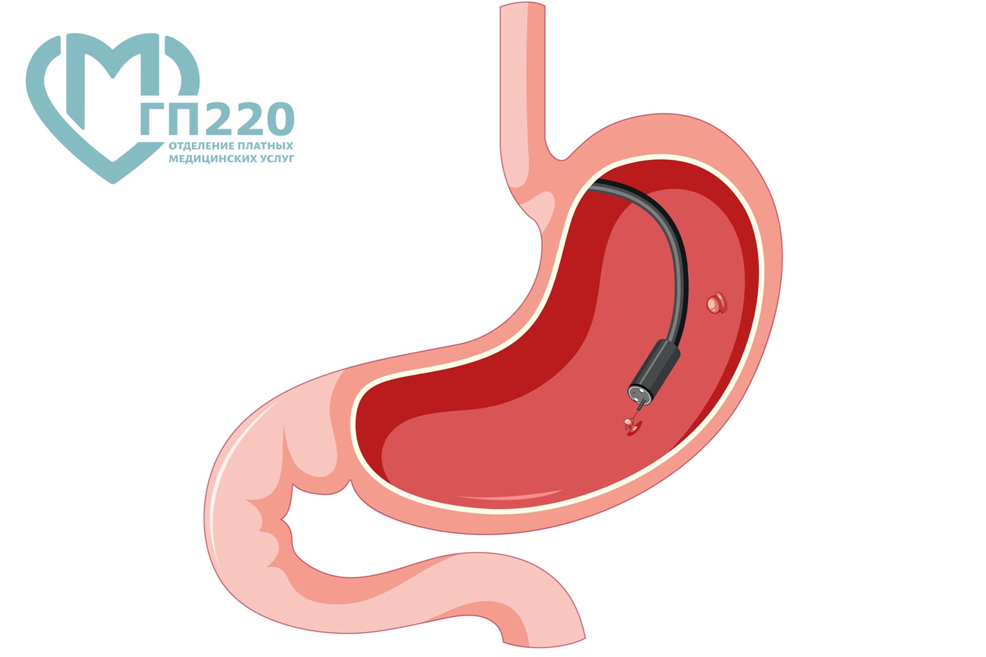 Гастроскопия на Красной Пресне