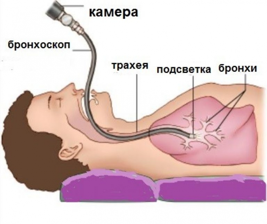 Кресло для бронхоскопии