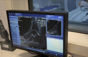 Магнитно-резонансная томография голеностопного сустава